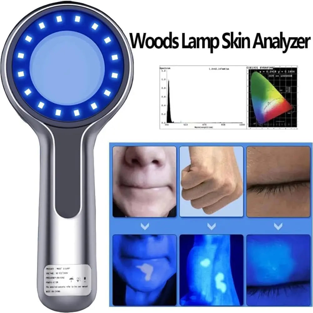 Woods Lamp Skin Analyzer For Skin 16leds UV 365nm Magnifying For Beauty Facial Testing Light Skin Analysis Detection Skin Care