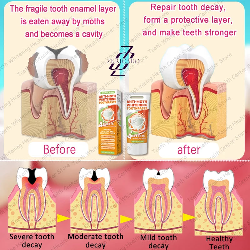 Cavity Repair & Healthy Teeth Solution - 99% Repurchase Rat | AlluCanFind