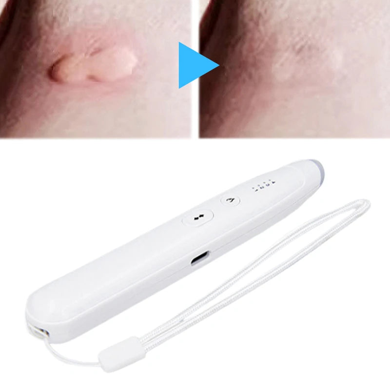 Xiaomi Portable Mosquito Bite Relief Pen Instant Itch Stopper for Adults Kids Rechargeable Natural Bug Bite Treatment Soothing