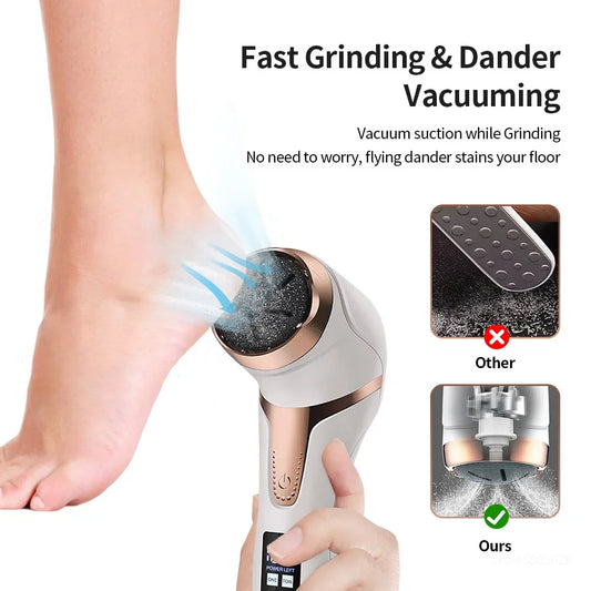Electric Heel & Foot Callus Remover
