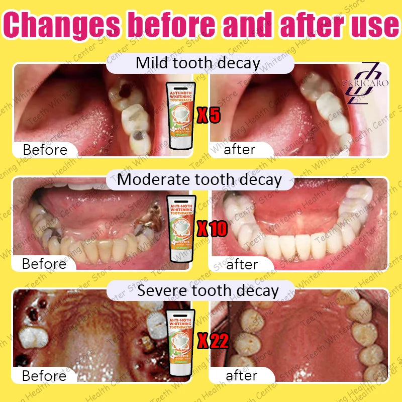 Cavity Repair & Healthy Teeth Solution - 99% Repurchase Rat | AlluCanFind