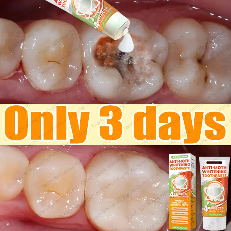Cavity Repair & Healthy Teeth Solution - 99% Repurchase Rat | AlluCanFind