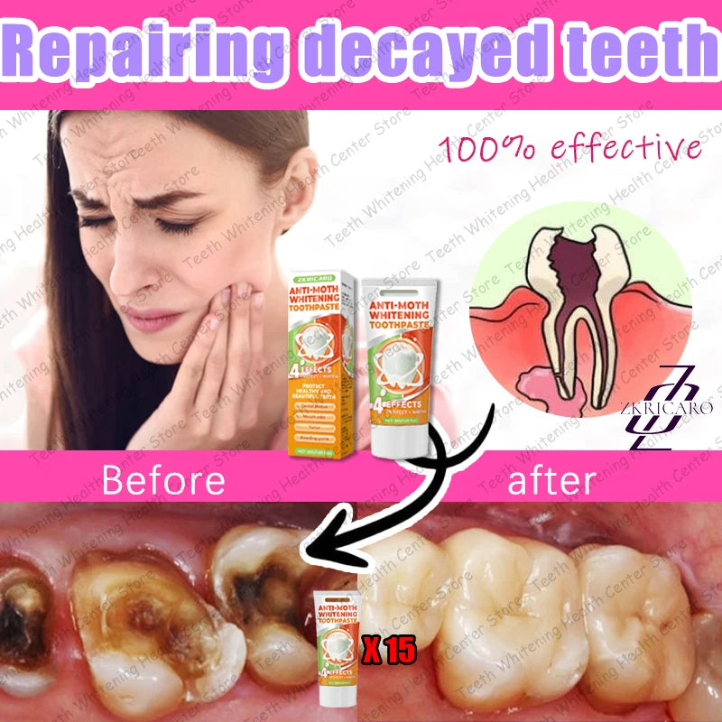 Cavity Repair & Healthy Teeth Solution - 99% Repurchase Rat | AlluCanFind