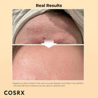 COSRX Snail Mucin 96% Power Repairing Essence - Hydrating Serum for Dull Skin & Fine Lines | AlluCanFind