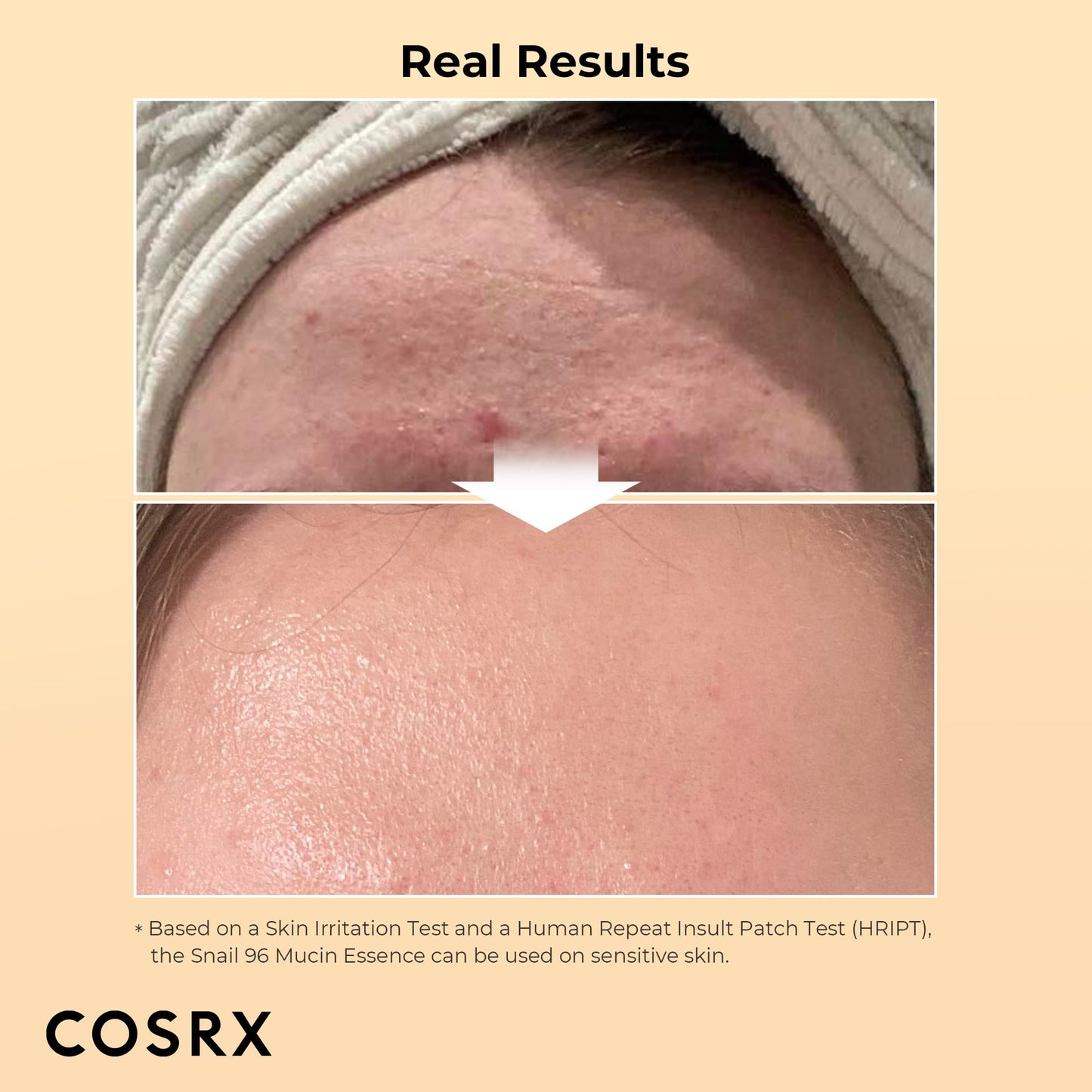COSRX Snail Mucin 96% Power Repairing Essence - Hydrating Serum for Dull Skin & Fine Lines | AlluCanFind