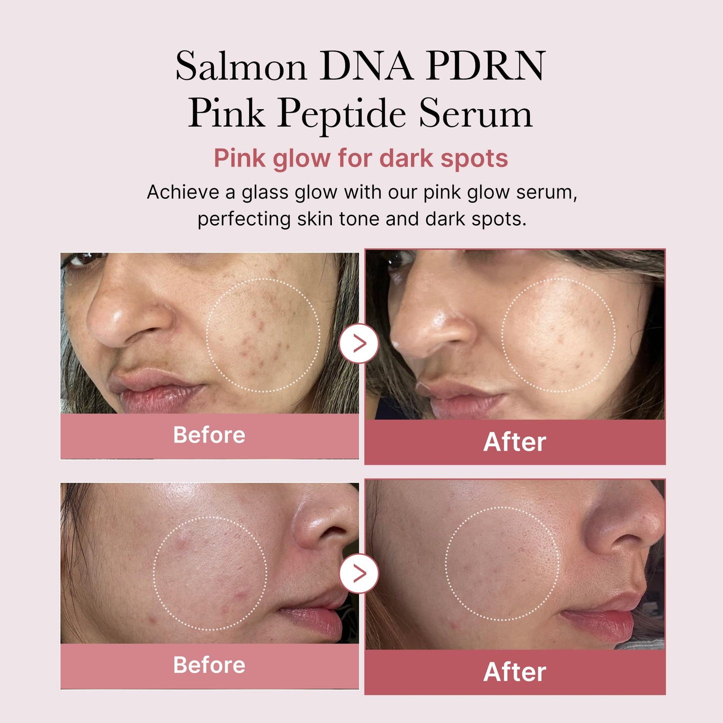 Medicube Salmon DNA PDRN Pink Glow Serum - Peptide & Niacinamide for Hydrating & Firming Skin | AlluCanFind