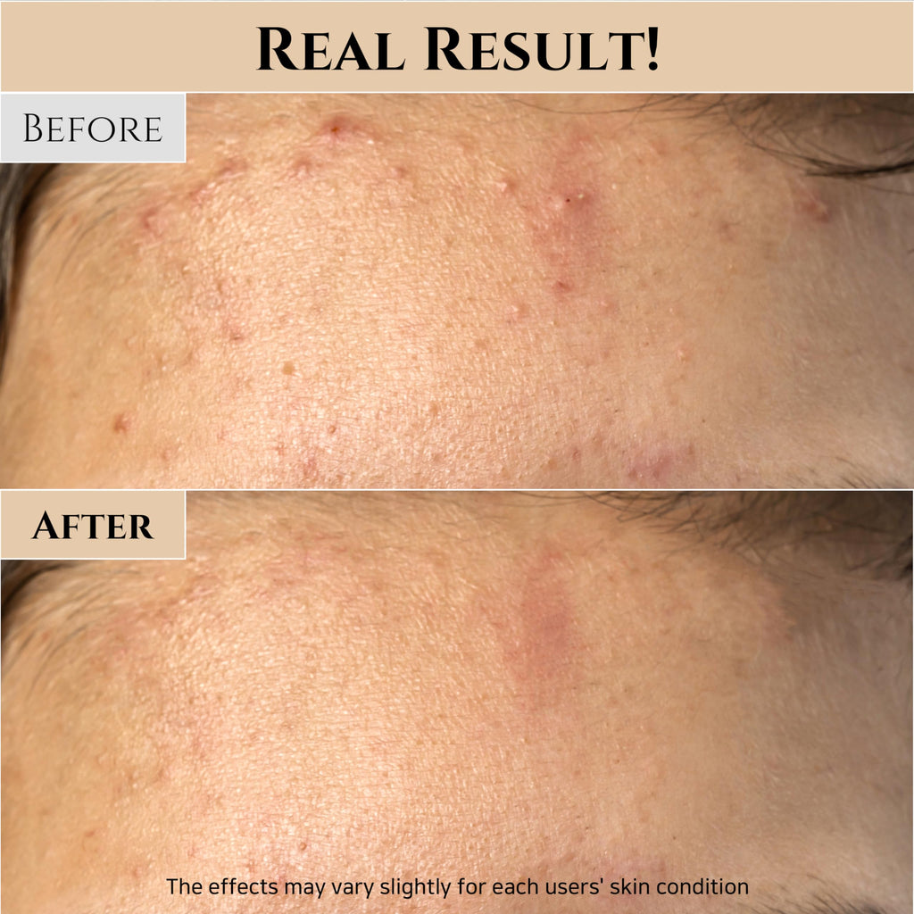 Beauty of Joseon Glow Mask with Rice & Honey, Pore & Sebum Care | AlluCanFind