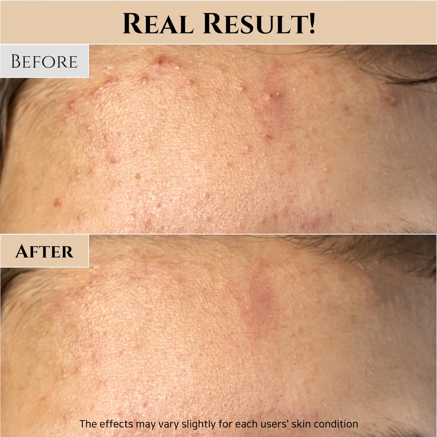 Beauty of Joseon Glow Mask with Rice & Honey, Pore & Sebum Care | AlluCanFind