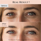 Beauty of Joseon Revive Eye Serum – Retinal & Niacinamide (30ml, 2-Pack)