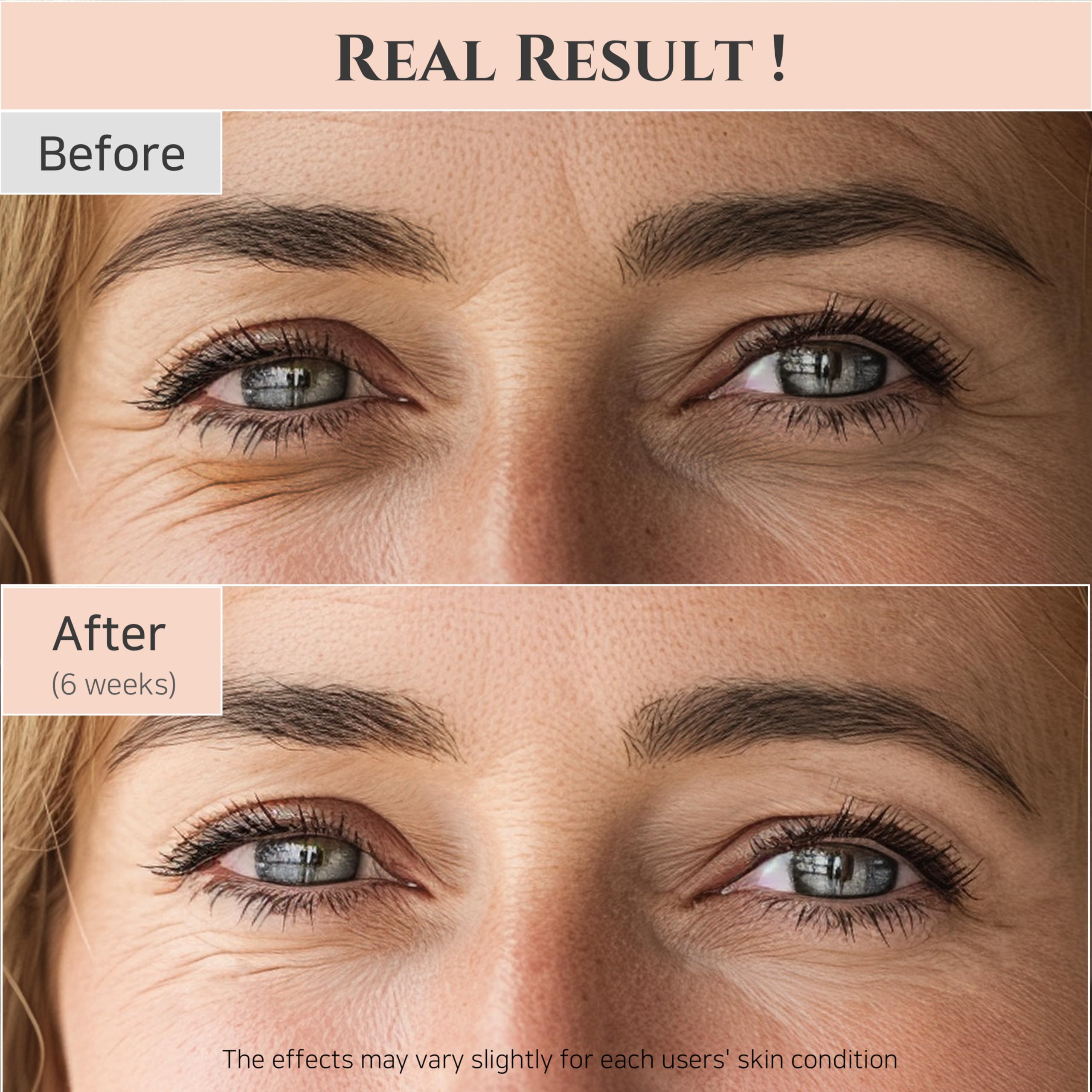 Beauty of Joseon Revive Eye Serum – Retinal & Niacinamide (30ml, 2-Pack)