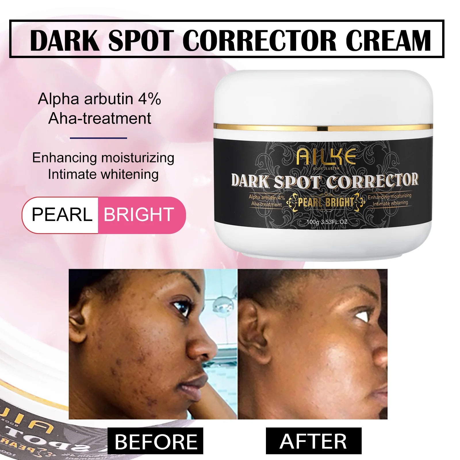 AILKE Collagen Skincare Set – Whitening, Moisturizing & Spot Removal