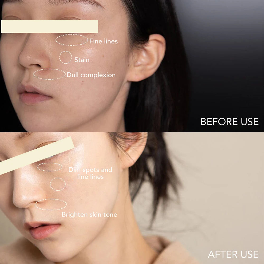 Dark Spot Corrector & Whitening Facial Cream SPF35+