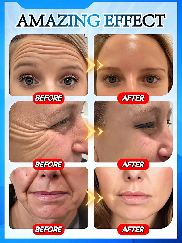 You can see the effect. No more wrinkles. Very beautiful