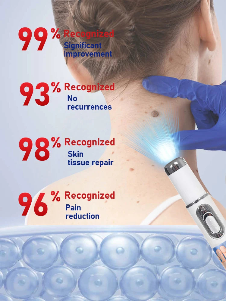 ᵂᵃʳᵗ ʳᵉᵐᵒᵛᵃˡ ᵃᵗ ʰᵒᵐᵉ ⁱˢ ˢᵘᵖᵉʳ ᶜᵒⁿᵛᵉⁿⁱᵉⁿᵗ! Warts will gradually fall off in 7 days