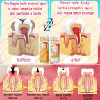 Cavity Repair & Healthy Teeth Solution - 99% Repurchase Rat | AlluCanFind
