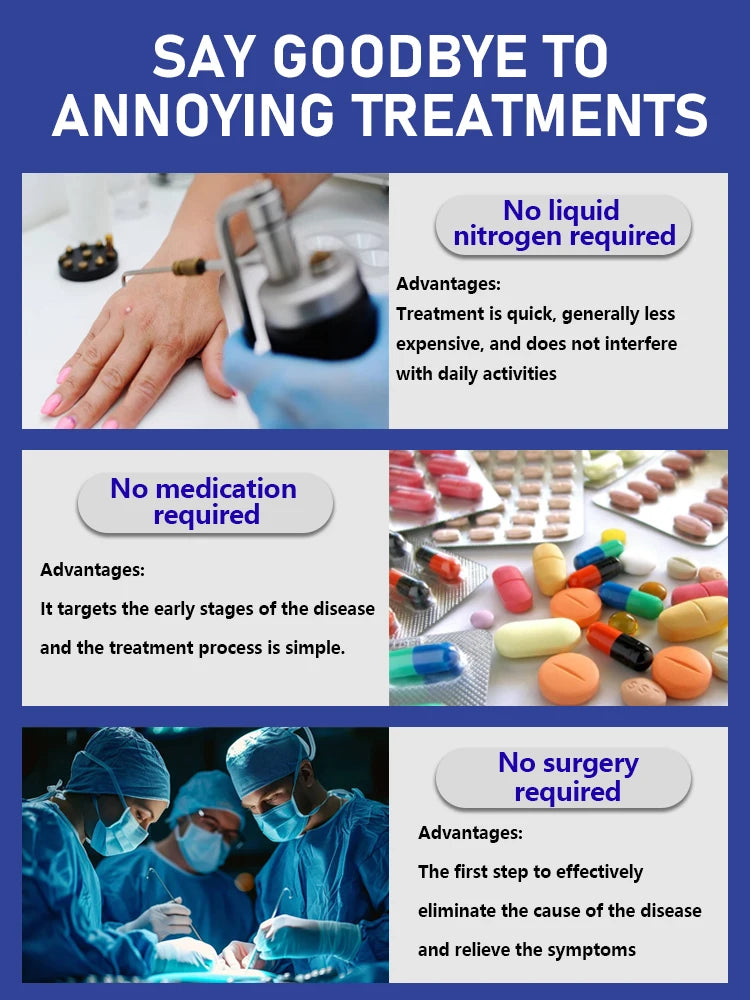 ᵂᵃʳᵗ ʳᵉᵐᵒᵛᵃˡ ᵃᵗ ʰᵒᵐᵉ ⁱˢ ˢᵘᵖᵉʳ ᶜᵒⁿᵛᵉⁿⁱᵉⁿᵗ! Warts will gradually fall off in 7 days