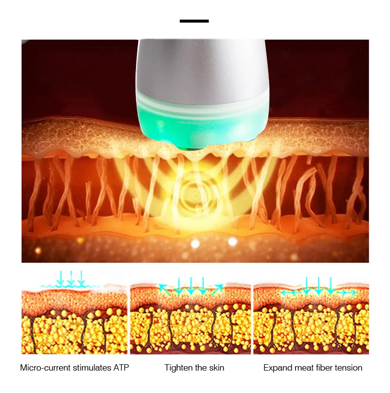 Professional mesotherapy machine electroporator radio frequency Device rf lifting machine needle free beauty skin care tool