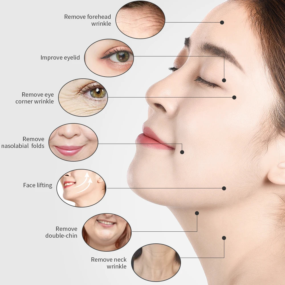 2MHz Tripolar Radio Frequency Face Body Skin Lifting Tightening Machine Eye Neck Anti-Wrinkle V-Face V-Line RF Beauty Device