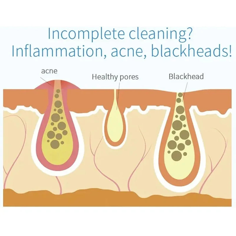 NEW Peeling Beauty Device Small Bubble Oxygen Injection Instrument Hydra Dermabrasion Aqua Facial Cleaning Suction Blackhead