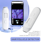 New 50X-200X Hair Follicles Scalp Detector Skin Analyzer Microscope Tool High Definition Skin Tester Support APP Wireless Use