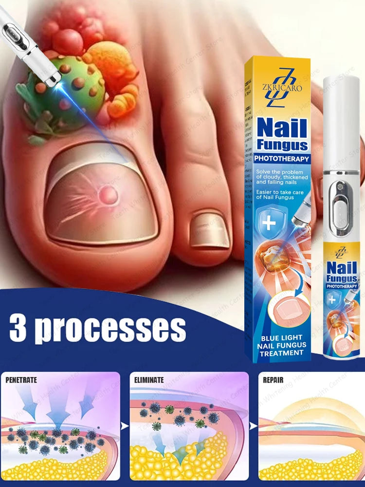 Nail cleaning tools to restore nail health.