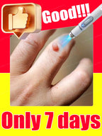 Wart Blue Light Tool, Easy-to-clean Skin Care Tool