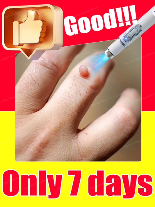 Wart Blue Light Tool, Easy-to-clean Skin Care Tool