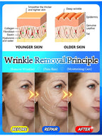 You can see the effect. No more wrinkles. Very beautiful