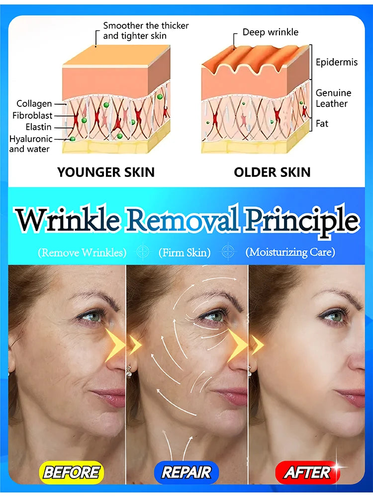 You can see the effect. No more wrinkles. Very beautiful