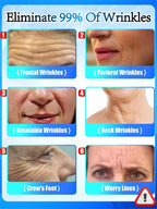 You can see the effect. No more wrinkles. Very beautiful