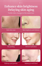 Skincare Ampoule Facial Essence PDRN Salmon Oxygen Stem Cell Serum Whitening Anti-Aging Hydrating Serum