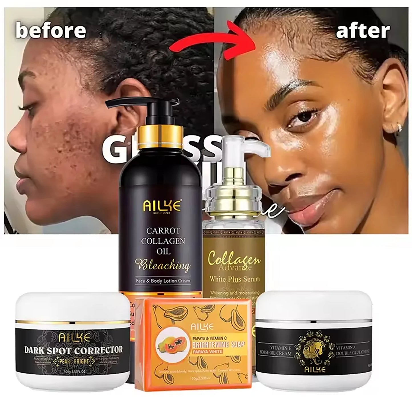 AILKE Collagen Skincare Set – Whitening, Moisturizing & Spot Removal