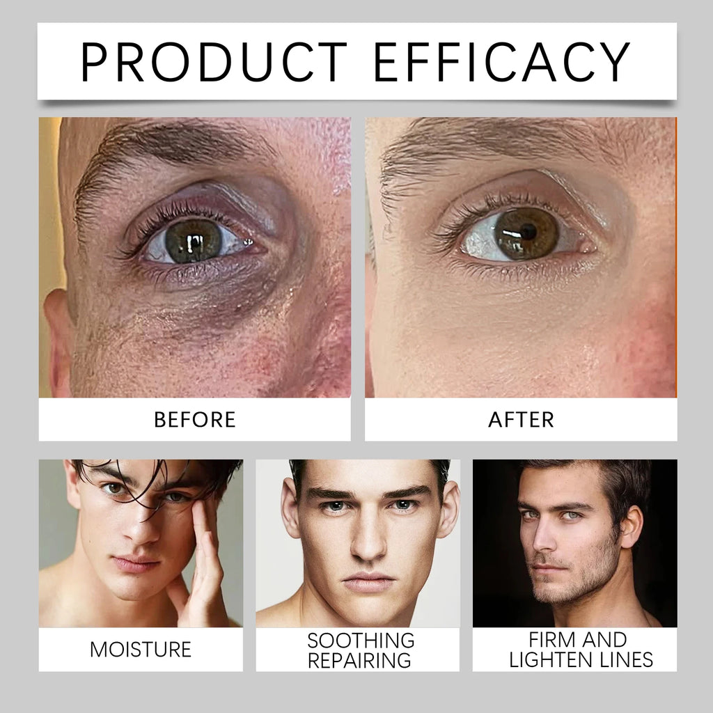 East Moon Wake Up Eye Cream Fade Fine Lines Reduce Dark Circles Eye Bags Puffiness Hydrating Moisturizer Men Eye Care Lotion