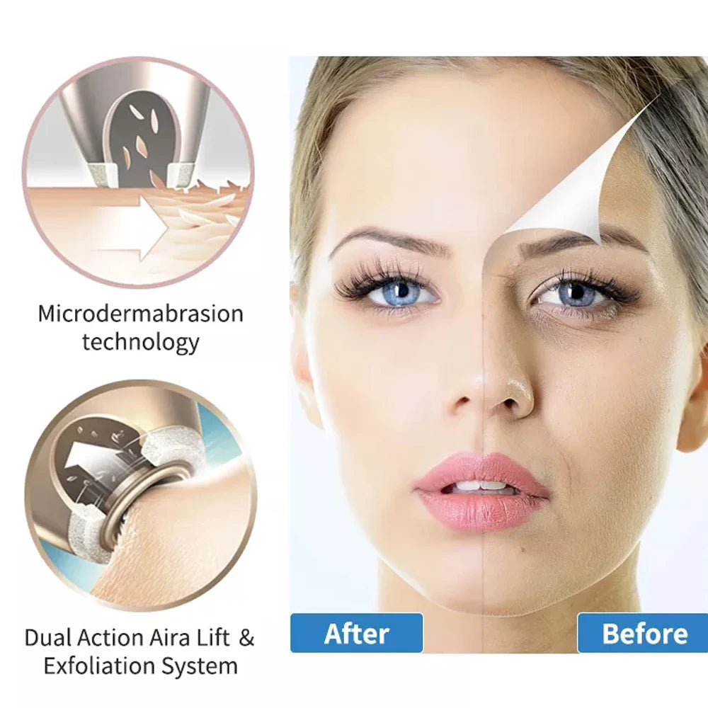 Wireless Diamond Microdermabrasion Machine For Blackhead Acne Removal Deep Cleaning Anti Aging Wrinkle Care Tool