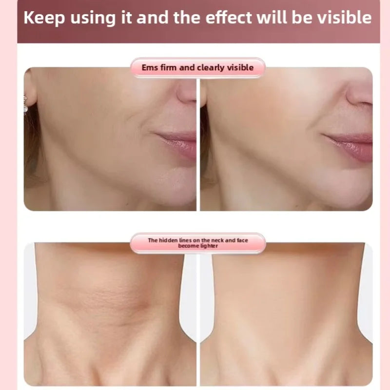 EMS Roller Face-Slimming Artifact V-Face Beauty Facial Massager For Firming And Lifting The Face