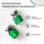 Algae Peeling Whitening Melasma Peel Kit – Natural Seaweed Extract Mask