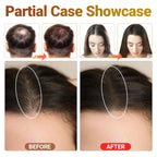 LED Triple Light Scalp Care Growth Hair Regrowth Device Anti Hair Loss Machine Thinning Scalp Stress Relief Follicle Activation
