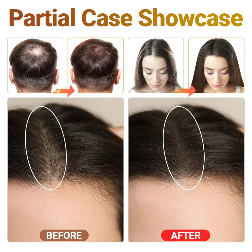 LED Triple Light Scalp Care Growth Hair Regrowth Device Anti Hair Loss Machine Thinning Scalp Stress Relief Follicle Activation